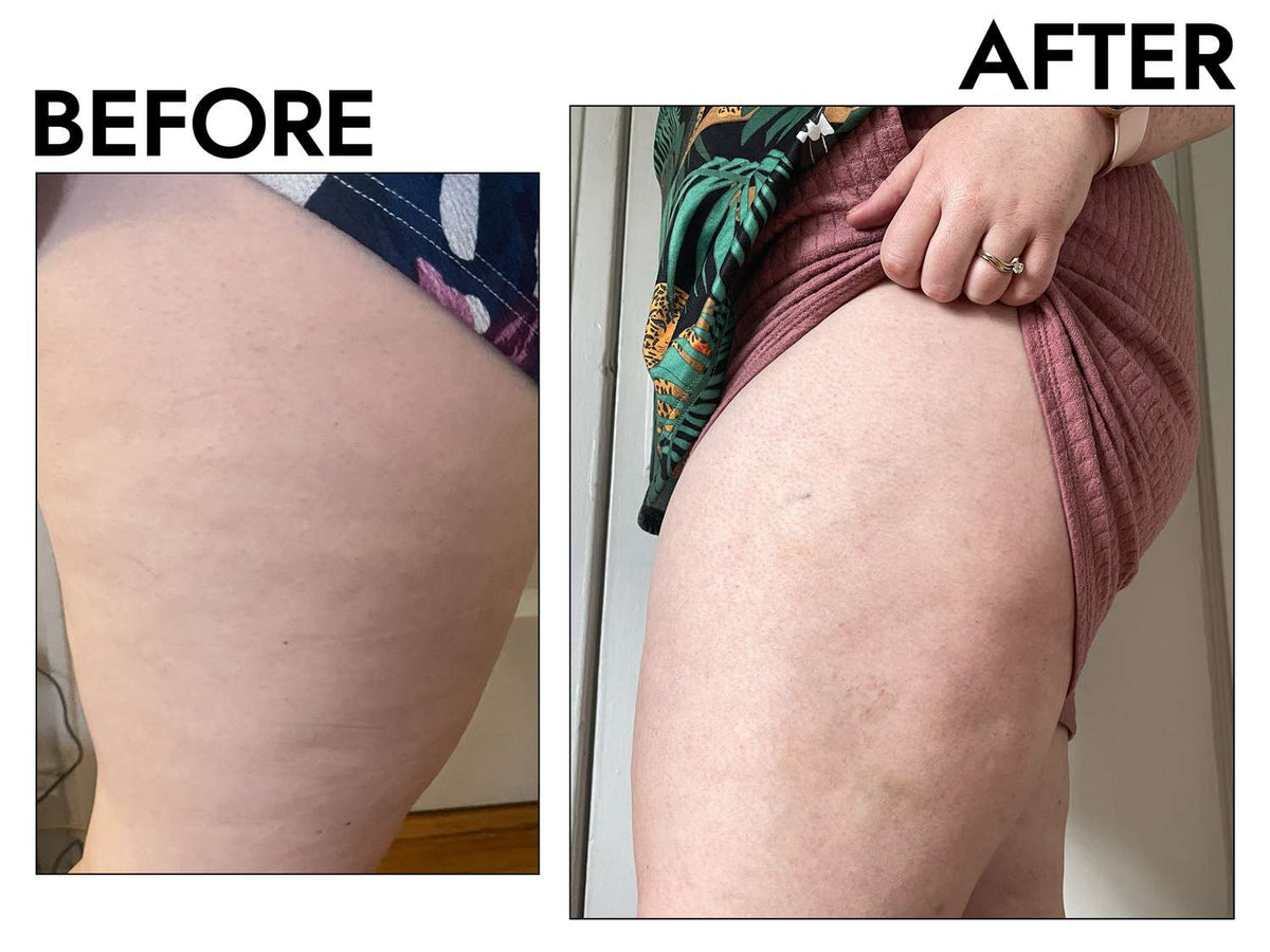 Gold-Infused Cryo-Thermo Firming Gel