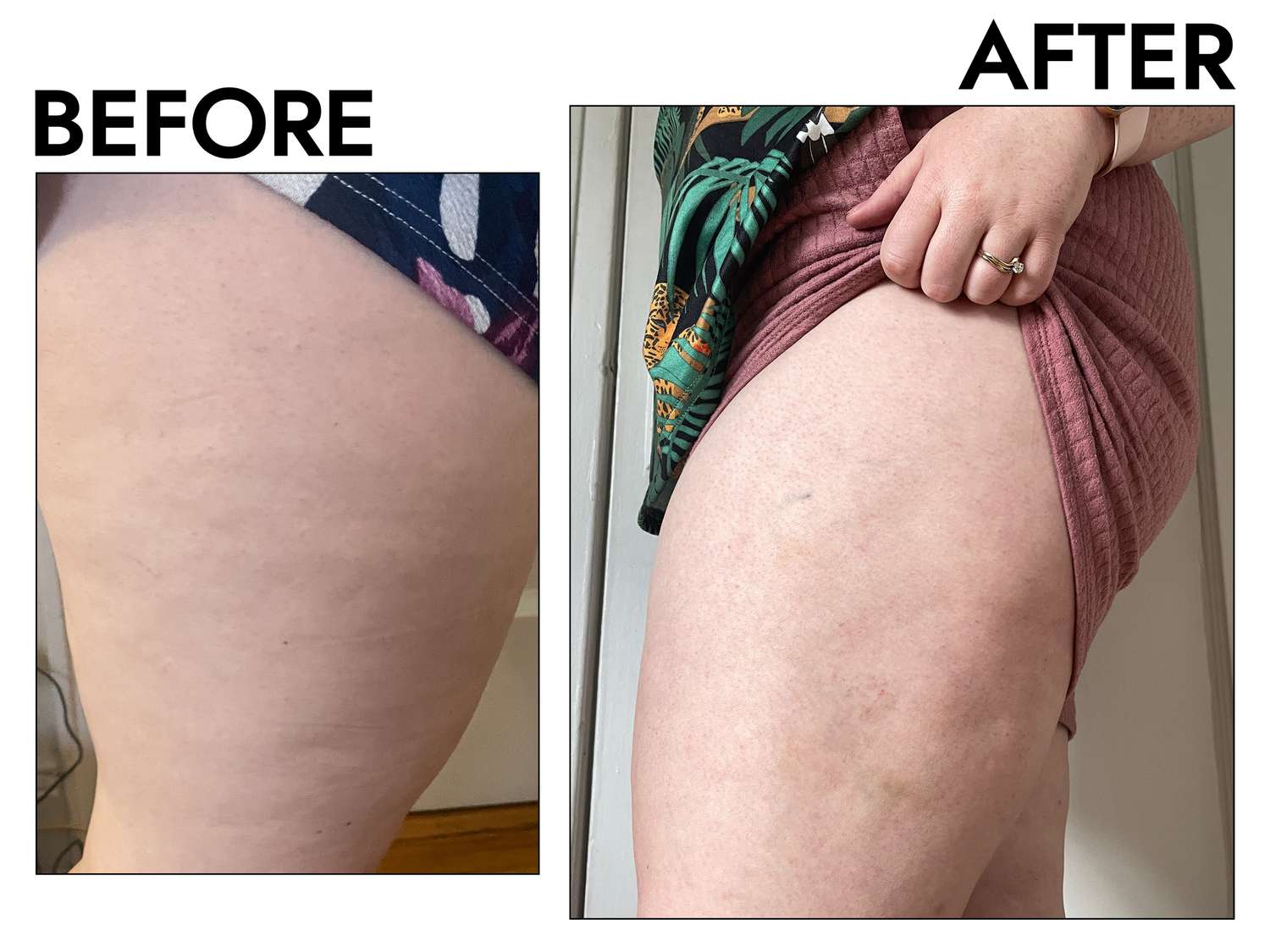 Gold-Infused Cryo-Thermo Firming Gel